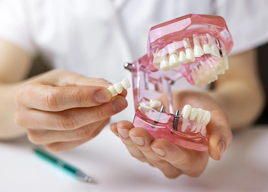 Dentist demonstrating proper flossing technique using dental model with teeth and gums