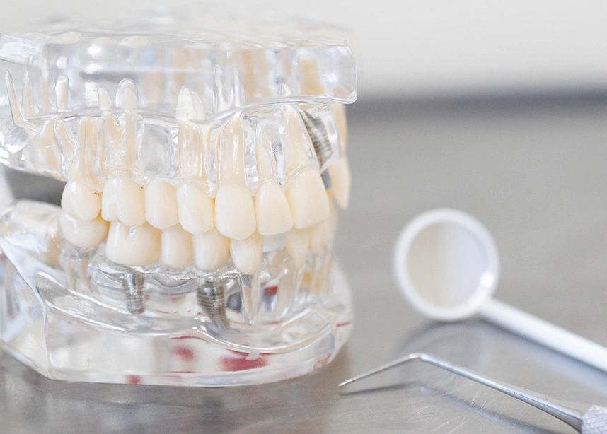 Clear dental model showing human teeth and jaw structure with dental mirror on white surface