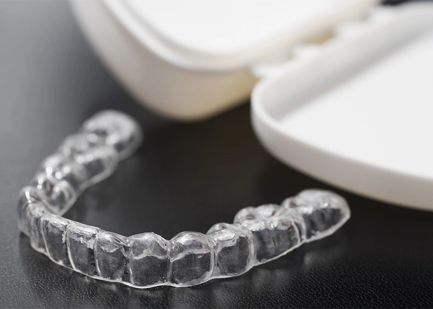 Clear dental aligner on black surface with white orthodontic molds in background