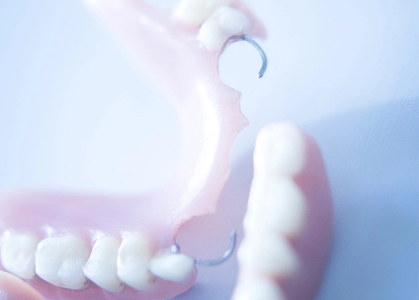 Hand holding partial denture above dental model showing teeth replacement options