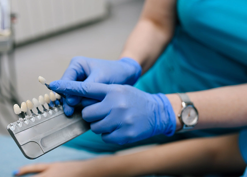 Dentist in blue gloves holding dental shade guide for teeth color matching procedure