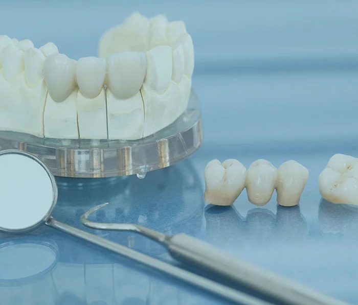 Dental crown model and prosthetic teeth samples with tools on blue medical background