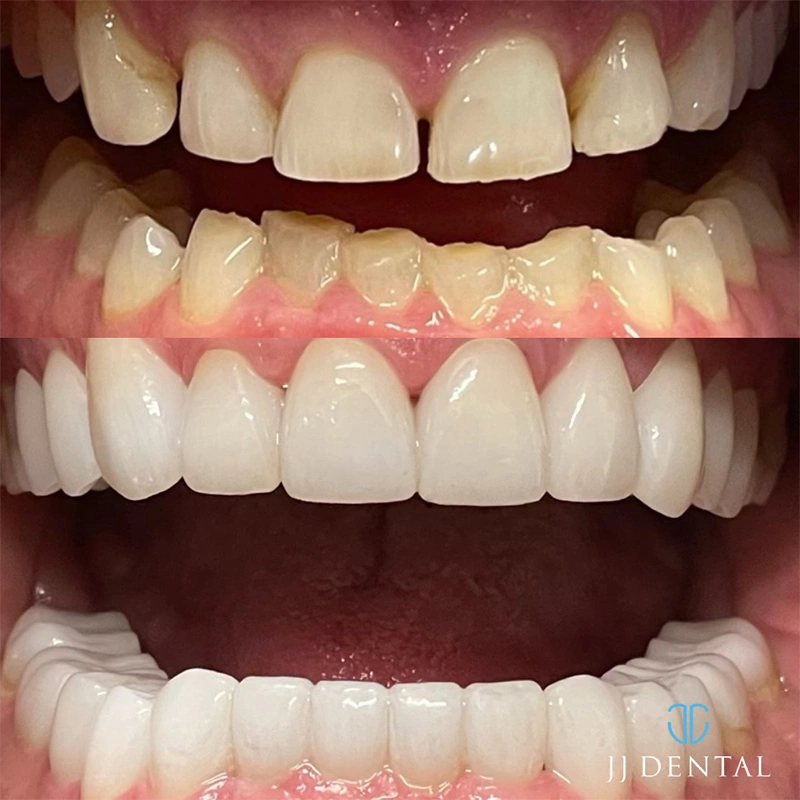 6130-p137-1-1